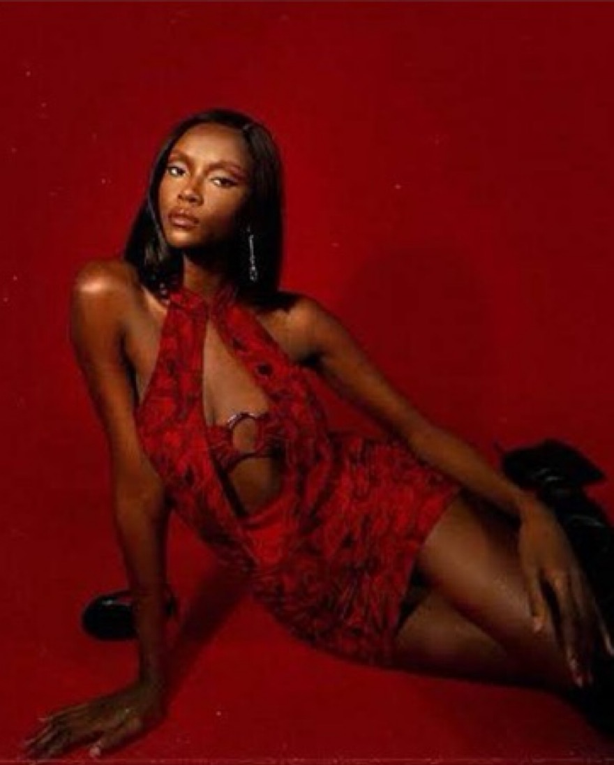 I AM GIA Medusa Dress - Image 2